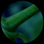 vine